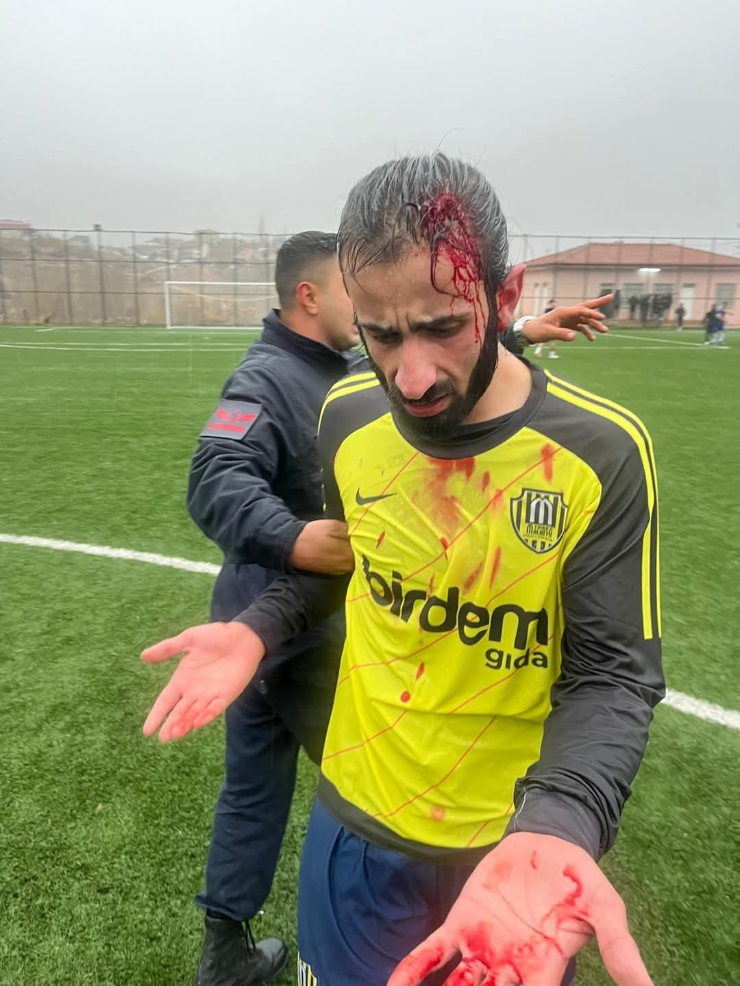 MALATYA 1 AMATÖR FUTBOL LİGİ'NİN  BAŞLAMASIYLA BİRLİKTE SAHADA İSTENMEYEN OLAYLAR..