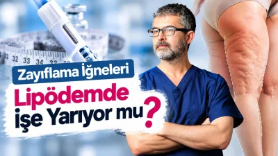 lipödem_084457347